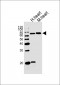 HAS2 Antibody (Center)